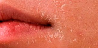 Estas enfermedades pueden agravarse con el frío: SSM