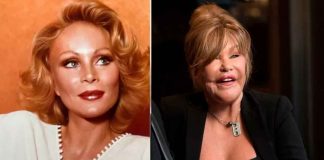 Muere la “mujer gato” conocida por sus cirugías estéticas extremas