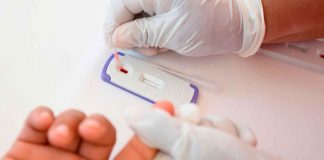 #Imagenes // Realiza SSM sin costo pruebas rápidas de detección de VIH
