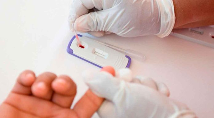 #Imagenes // Realiza SSM sin costo pruebas rápidas de detección de VIH
