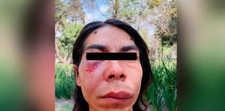 #Video // Funcionarios de CDMX hacen uso de la fuerza y golpean a mujer trans