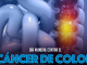 Cáncer de Colon, detectarlo a tiempo es clave para salvar vidas: SSM