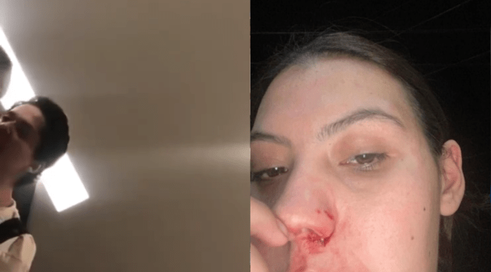 #VIDEO | Joven estudiante graba a escondidas momento en que su novio la golpea y agrede