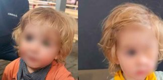 #Internacional | Niño de 2 años pierde un ojo tras ser besado por alguien con herpes labial