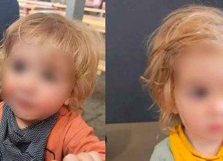 #Internacional | Niño de 2 años pierde un ojo tras ser besado por alguien con herpes labial