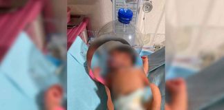#Video | Ante la falta de insumos usan botella de plástico para oxigenar a un recién nacido en #Tabasco en IMSS-Bienestar
