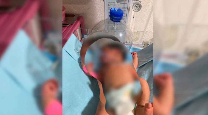 #Video | Ante la falta de insumos usan botella de plástico para oxigenar a un recién nacido en #Tabasco en IMSS-Bienestar