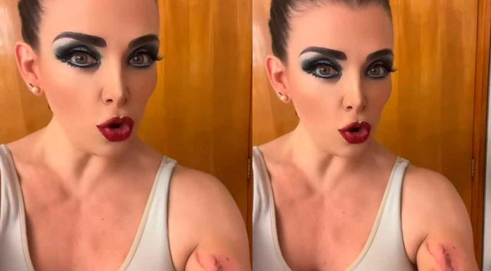 #Video | Actriz Lisset denuncia peligro de coladeras en mal estado en CDMX tras accidente