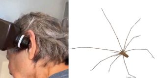 #VIDEO #Viral | ¡Terror en el oído! Mujer descubre que tenía una araña viva en su oreja