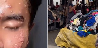 Influencer contrae virus contagioso por usar ropa de paca sin lavar