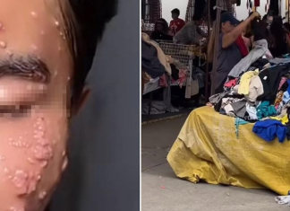 Influencer contrae virus contagioso por usar ropa de paca sin lavar