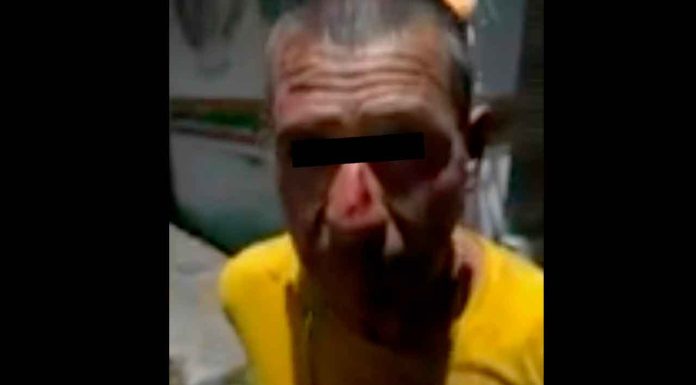Presunto ladrón es sorprendido por vecinos, golpeado y le amputaron un dedo, en Uruapan