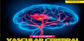 Cómo identificar signos de alarma de una enfermedad vascular cerebral: SSM