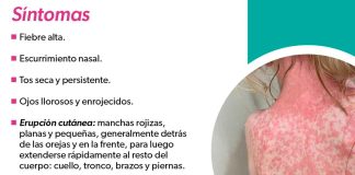 Identifica los síntomas del sarampión y protege tu salud: SSM