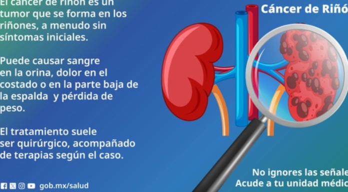 Secretaría de Salud invita a la población a prevenir el cáncer de riñón que afecta principalmente a personas mayores de 50 años