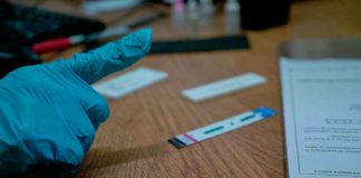 SSM realiza sin costo prueba rápida para detectar la hepatitis C