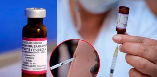 Vacunas contra el sarampión disponibles en centros de salud: SSM