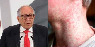 Sarampión en México: 3 mil 500 casos y 12 defunciones, reporta Secretaría de Salud