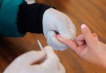 SSM realiza pruebas gratuitas de VIH en centros de salud