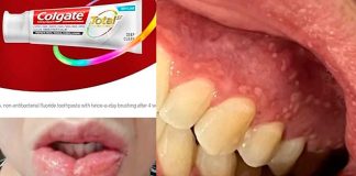 Colgate-Palmolive bajo la lupa: retira pasta dental tras reportes de daños bucales en algunas partes de America-Latina