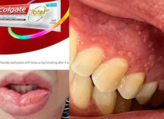 Colgate-Palmolive bajo la lupa: retira pasta dental tras reportes de daños bucales en algunas partes de America-Latina