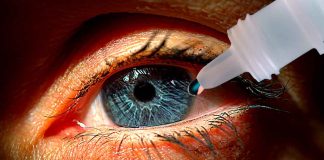 #México: Mujer se confunde y se pone kola loka en lugar de gotas en los ojos; se recupera de una cirugía