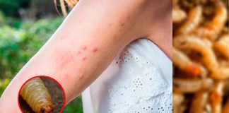 Detectan en EE. UU. el primer caso humano de gusano barrenador en décadas