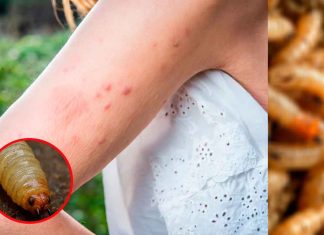 Detectan en EE. UU. el primer caso humano de gusano barrenador en décadas