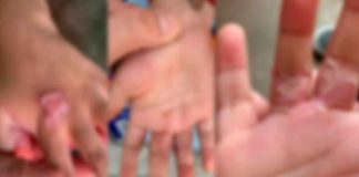 #México: Dos niños son rescatados del novio de su madre; colocaba sus manos en el comal “por no calentar bien las tortillas”