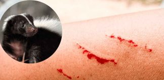 Detectan 3 casos sospechosos de rabia en personas que tuvieron contacto con joven infectada en Zacatecas