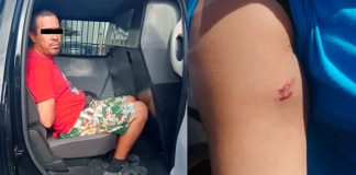 #México: Hombre muerde y golpea a cajera de una tienda porque no había sistema y quería saldo en su celular