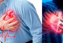#PREVENCIÓN || Infarto agudo al miocardio: Reconocerlo a tiempo salva vida