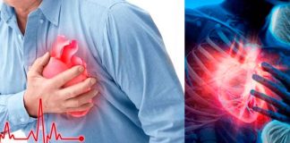 #PREVENCIÓN || Infarto agudo al miocardio: Reconocerlo a tiempo salva vida