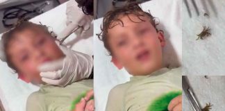#VIDEO #VIRAL || Un niño en Cancún terminó con un pequeño cangrejo dentro del oído mientras nadaba