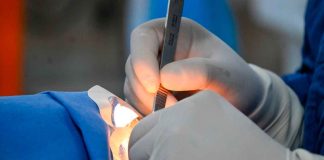 DIF Municipal de Zacapu llevó a cabo jornada de cirugías de pterigion a bajo costo