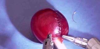 #VIDEO || El asombroso sistema quirúrgico Da Vinci y su precisión milimétrica