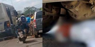 Entre la vida y la muerte adulto mayor que fue arrollado por microbús