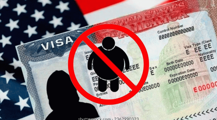 Estados Unidos endurece políticas migratorias: personas con obesidad podrían perder la residencia