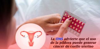 OMS advierte que el uso prolongado de la píldora anticonceptiva se asocia con mayor riesgo de cáncer de cuello uterino