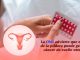 OMS advierte que el uso prolongado de la píldora anticonceptiva se asocia con mayor riesgo de cáncer de cuello uterino