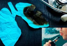 Vapeo bajo la lupa: evidencia científica confirma daños en pulmones, corazón y sistema nervioso