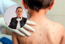 Salud descarta restricciones en Chiapas pese a detección de casos de sarampión