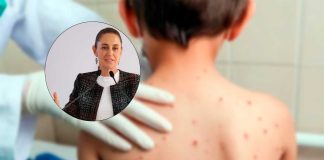 Salud descarta restricciones en Chiapas pese a detección de casos de sarampión