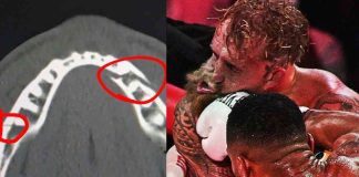 Anthony Joshua noquea a Jake Paul y le fractura la mandíbula en pelea transmitida por Netflix