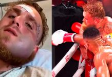 Jake Paul revela cómo quedó su mandíbula tras el nocaut ante Anthony Joshua