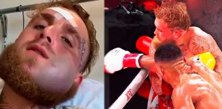 Jake Paul revela cómo quedó su mandíbula tras el nocaut ante Anthony Joshua