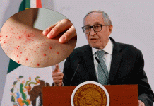 Salud descarta alarma por casos de sarampión en Chiapas; llaman a reforzar vacunación