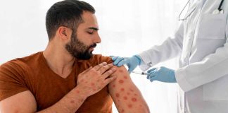 México tiene dos meses para contener el brote de sarampión y conservar estatus sanitario