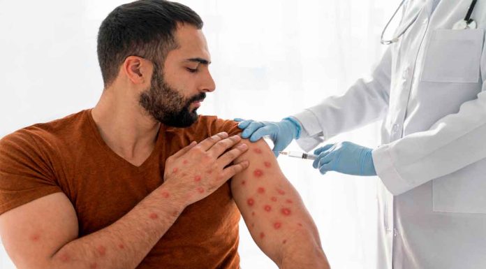 México tiene dos meses para contener el brote de sarampión y conservar estatus sanitario