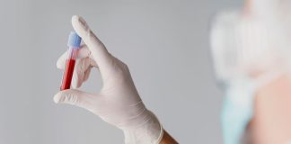 Científicos hallan variante genética hereditaria que protege contra la leucemia y otros cánceres de la sangre